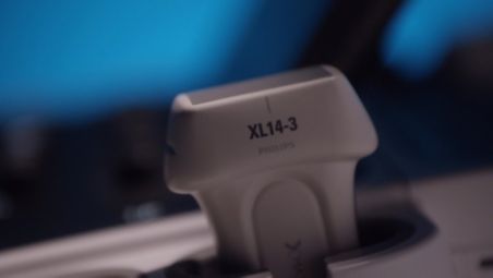 xMATRIX transducers, powerful and versatile