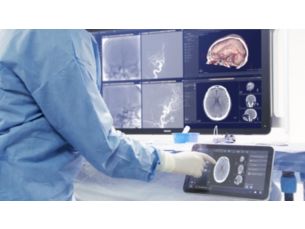 SmartCT Soft Tissue Helical Neuro imaging technology
