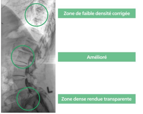 Amélioration d’image multi-échelle