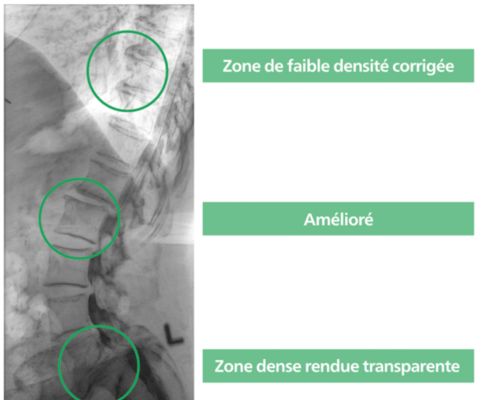 Optimisation des images multi-&eacute;chelle