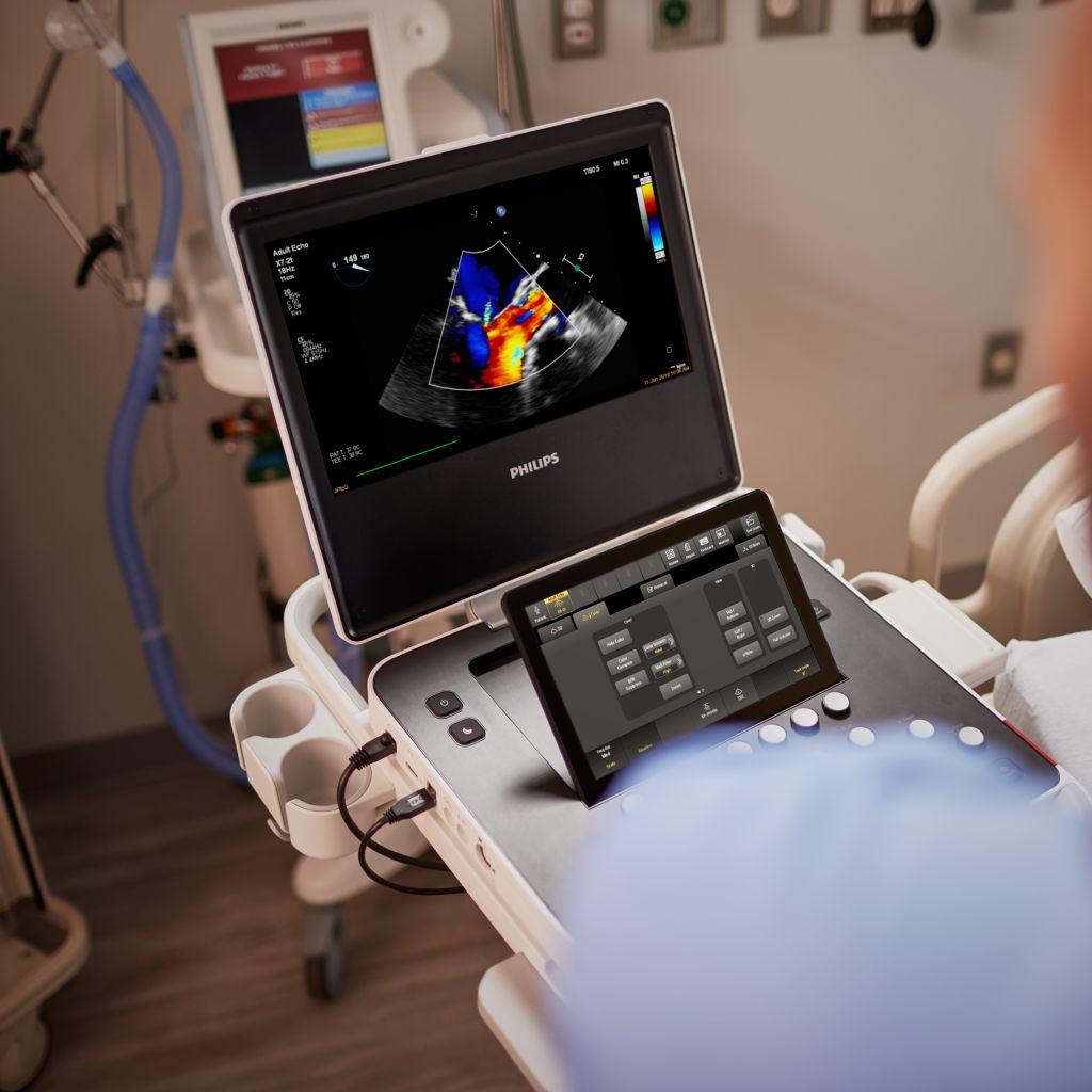 Compact Ultrasound system for Cardiology, 5500 CV