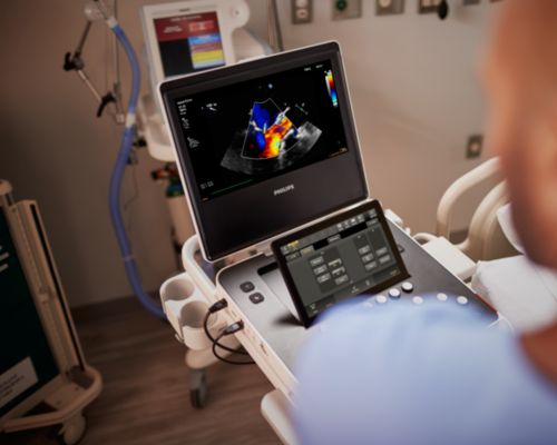 Compact Ultrasound system for Cardiology, 5500 CV