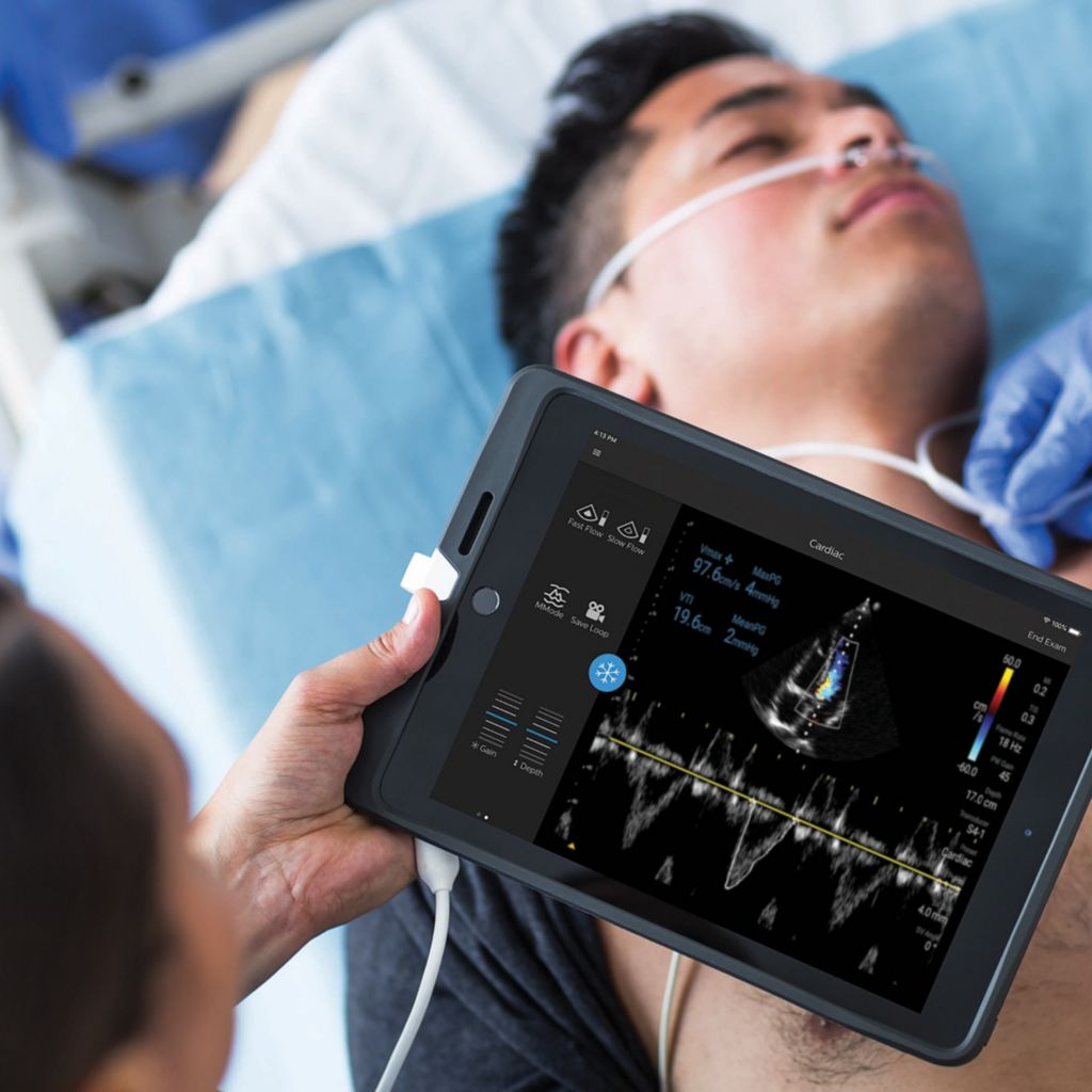 Lumify handheld ultrasound system