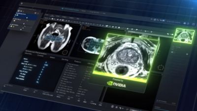 Vista previa de imagen de RM generada por IA para la planificación de exploraciones, impulsada por NVIDIA