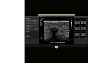 Anatomically Intelligent ultrasound - machine intelligence for faster more reproducible analysis