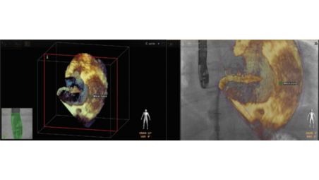 Всегда одинаковые ориентация и угол обзора