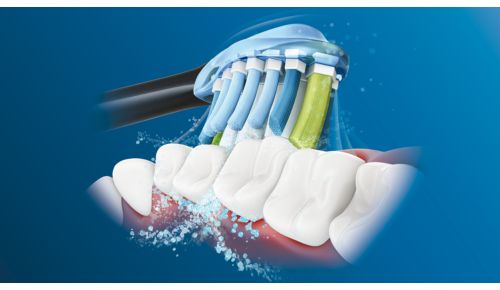 Philips Sonicares avancerede soniske teknologi