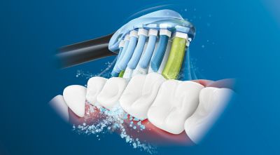 Philips Sonicare's advanced sonic technology