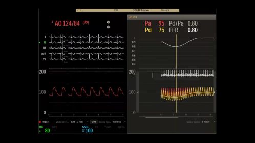 Hemo user interface FFR exam room
