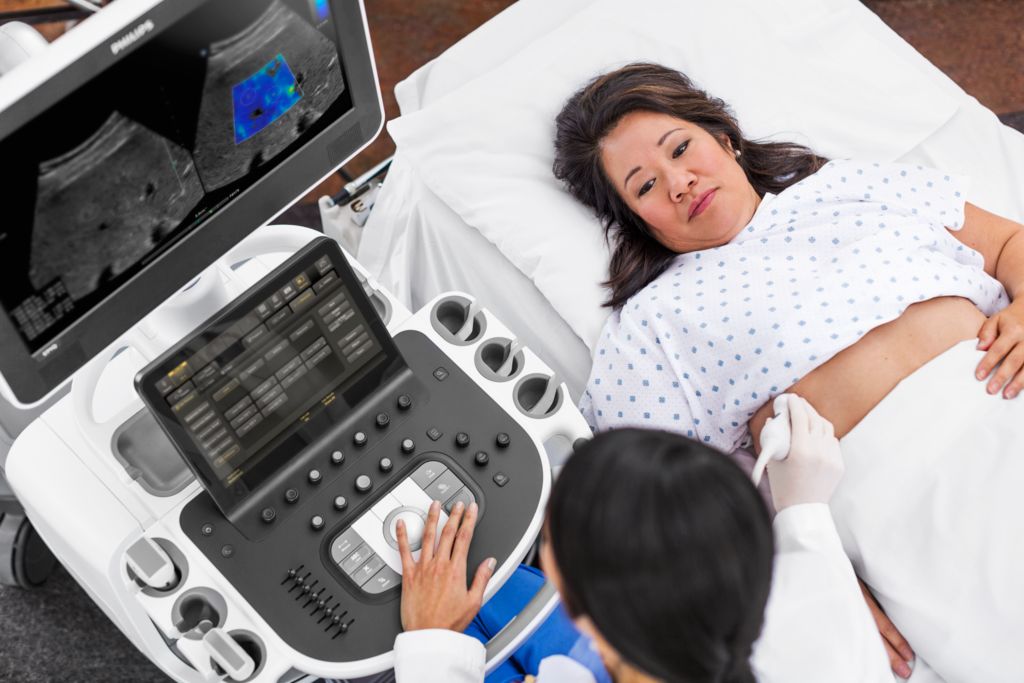 Onderhoudscontracten voor echografie