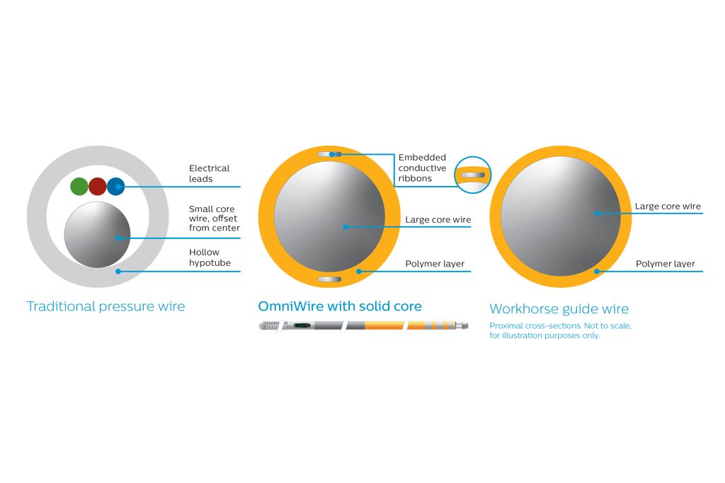 Until now, all pressure wires used a hollow hypotube to house electrical leads or optical fibers that carry the pressure signals. OmniWire uses a solid construction with conductive ribbons embedded in its outer layer. This innovation makes a larger solid core possible, similar to the design of your workhorse wire, providing the handling and durability needed for complex and multi-vessel cases.