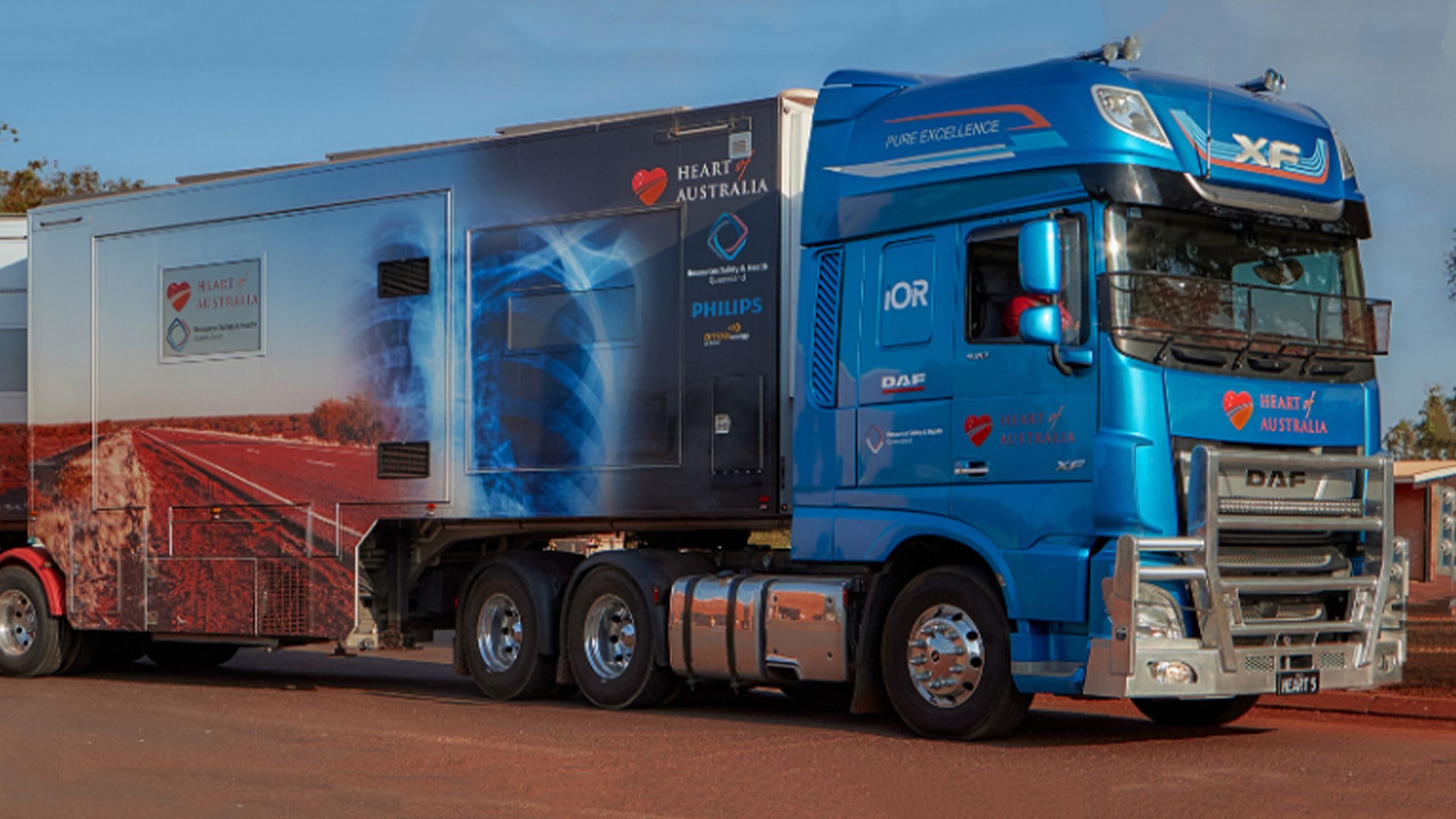 Mobile lung screening truck equipped with medical imaging technology in rural setting