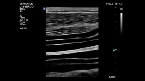 L12-3ERGO Lower Limb Veins