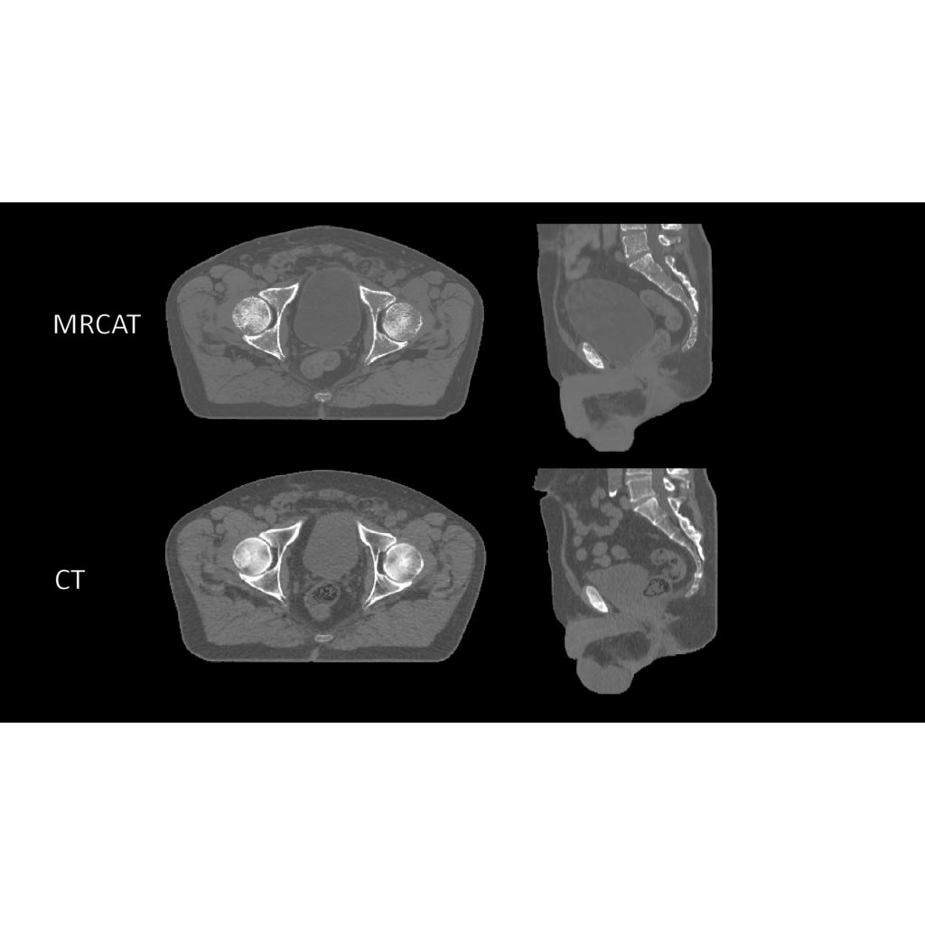 Accuracy in dose planning