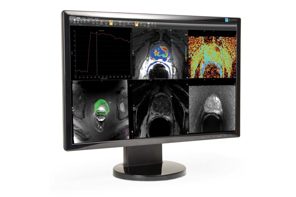 Images are displayed in ready-to-read, custom hanging protocols.