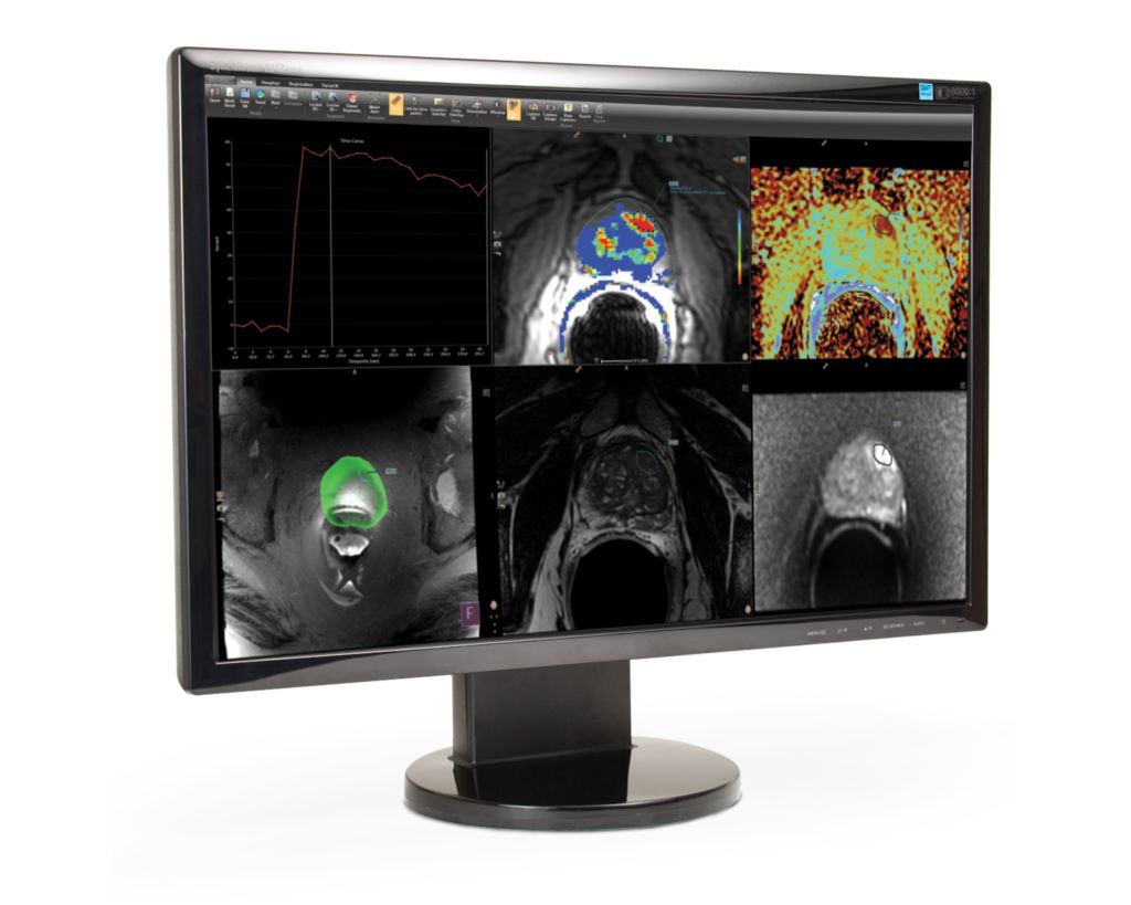 DynaCAD Prostate Advanced post-processing imaging system for Prostate MRI analysis