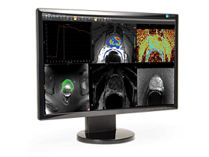 DynaCAD Prostate Advanced visualization for prostate MRI analysis