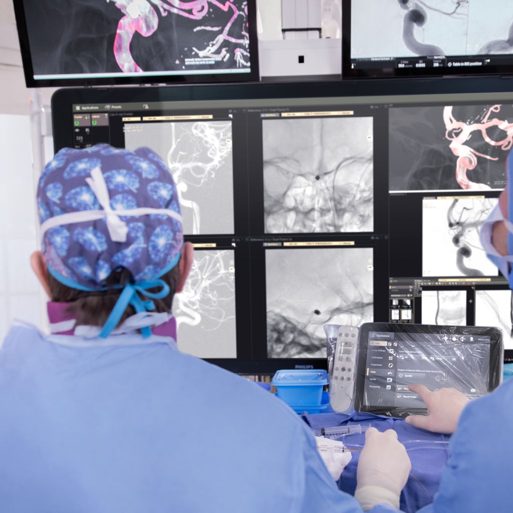 Azurion system with the SmartCT