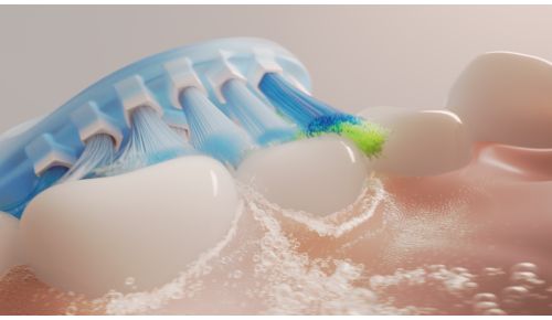 Sonicare Flüssigkeitsströmung