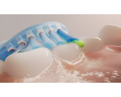 Sonicare Fluid Action