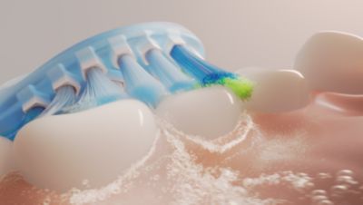 Proven Sonicare technology
