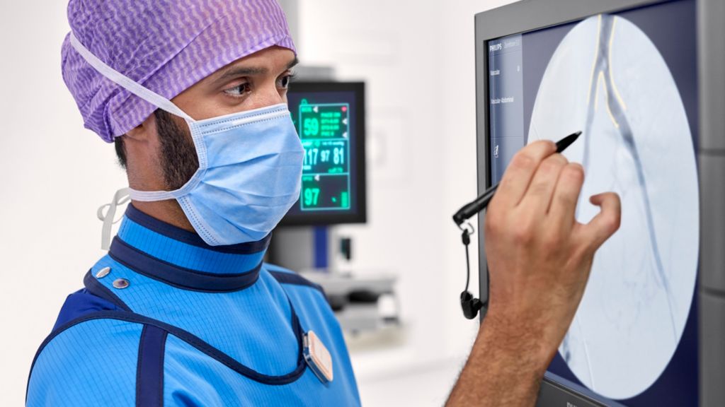 Surgical team performing urology case with Zenition FD mobile C-arm