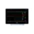IntelliVue MX750 front product photo thumbnail