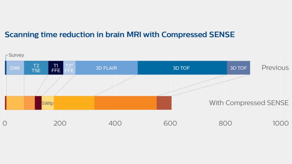 Scanning time reduction in Brain MRI with Compressed SENSE