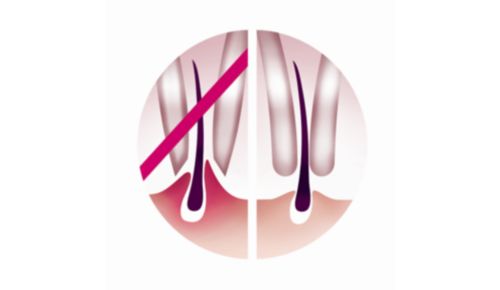 I dischi e le pinzette rimuovono i peli senza strapparli