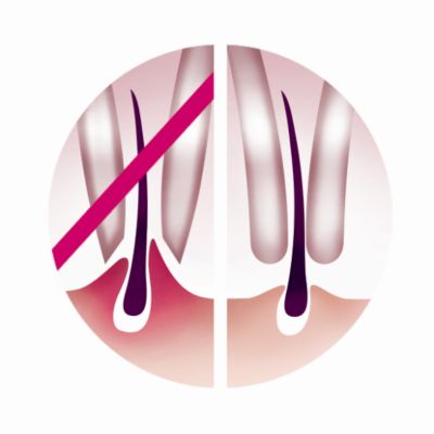 Gentle tweezing discs remove hair without pulling skin