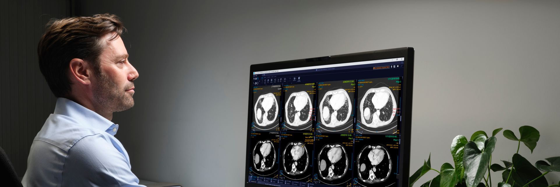 Radiologist looking at PACS from home