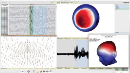 High density EEG montages