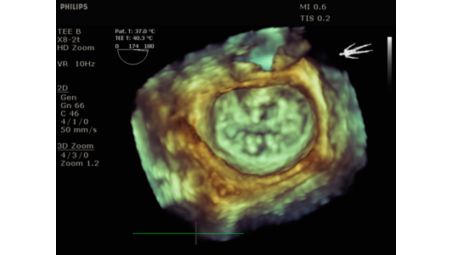 Extreme imaging for surgery