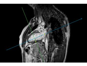 SmartHeart MR Clinical Applications