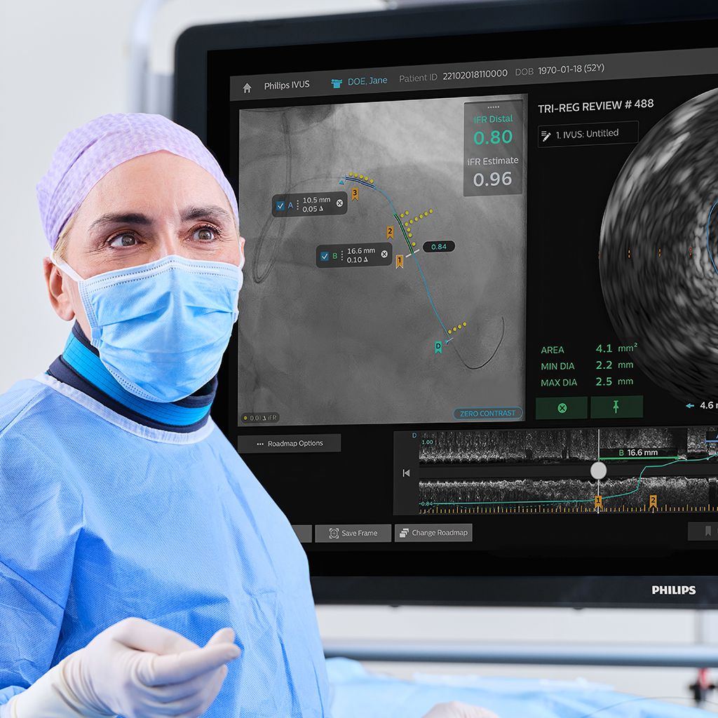 Physician with boom monitor showing IVUS and tri-registration