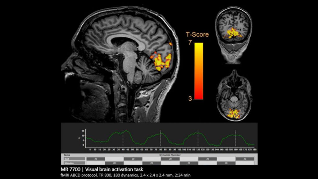 fMRI