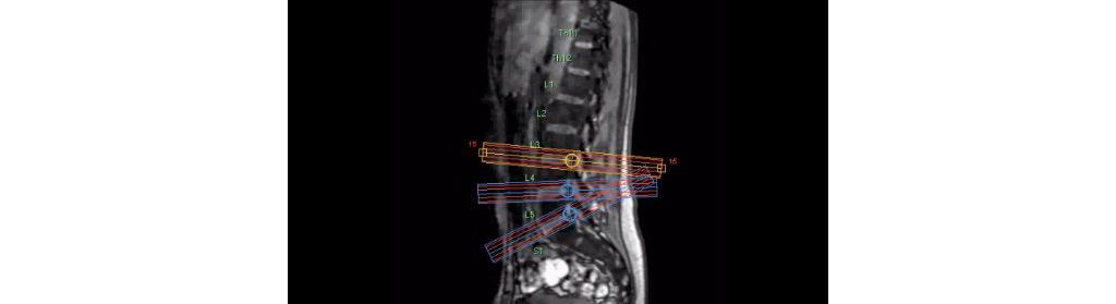 SmartExam Spine