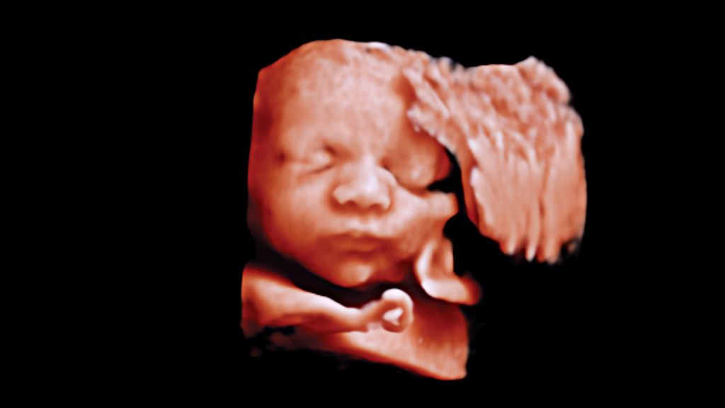 3D image of fetal face
