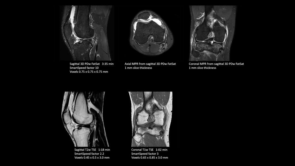 Philips SmartSpeed knee scans