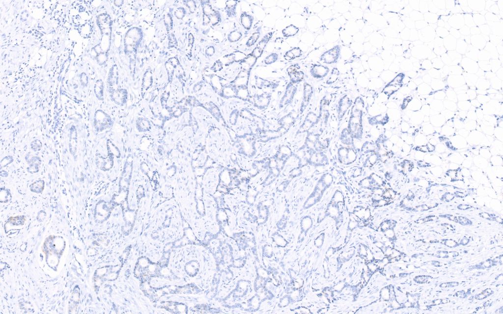 Clinical image digital pathology