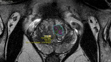 Enhanced targeting of ROIs