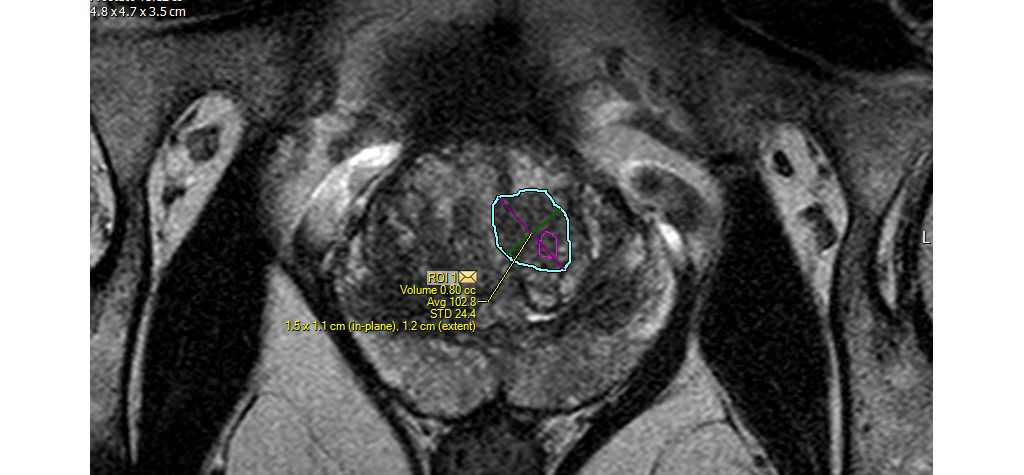 Enhanced targeting of ROIs