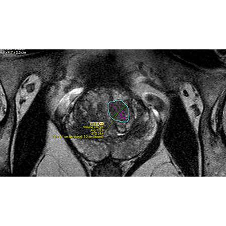 Enhanced targeting of ROIs
