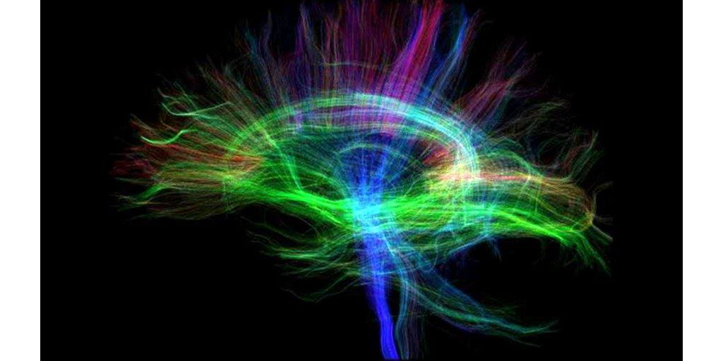 New territories in neurofunctional MRI - SP to Elition X