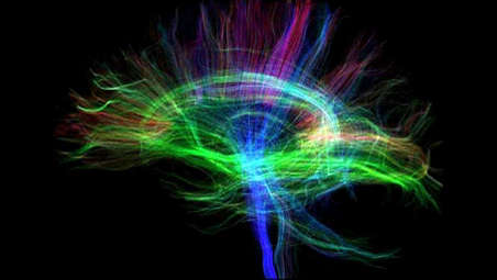 New territories in neurofunctional MRI