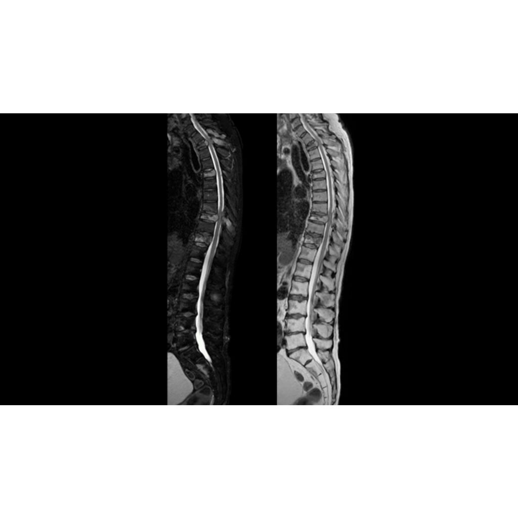 Fast, uniform, complete and consistent fat-free imaging