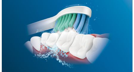 Продвинутая звуковая технология Philips Sonicare