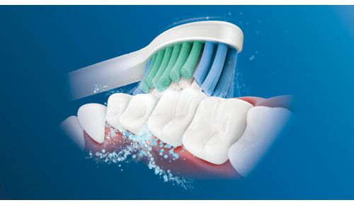 Philips Sonicare's advanced sonic technology