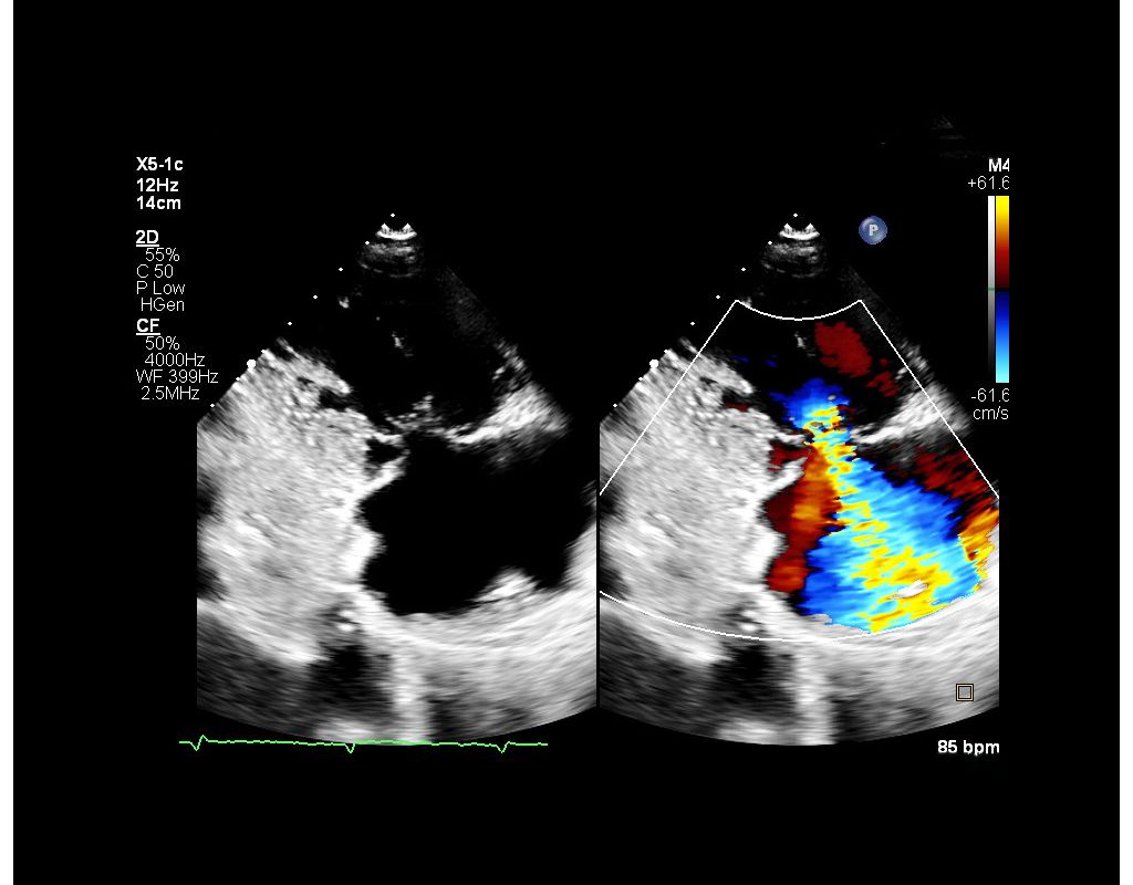 x5-1c Doppler CF