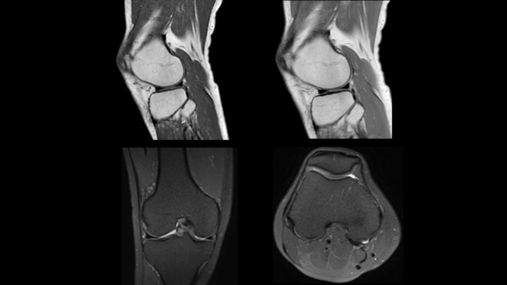 Knee